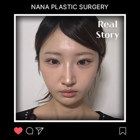 김주영님의 안면윤곽 후기