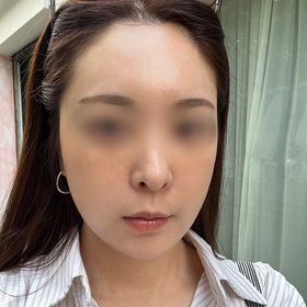 보뽀모뽀미님의 리프팅 후기