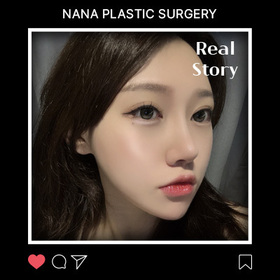 진찐진찐이양님의 안면윤곽3종 후기