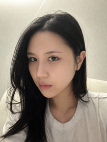 바람솔솔님의 매몰쌍꺼풀, 듀얼트임 후기