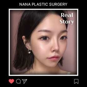 송유나님의 안면윤곽 후기