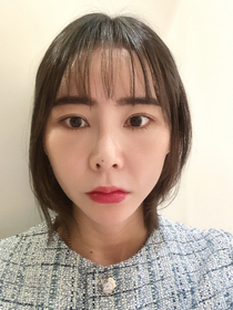 딸기우유잔뜩님의 매몰쌍꺼풀, 앞트임 후기
