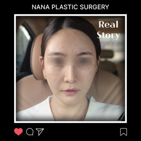 장혜진님의 연조직윤곽술 후기