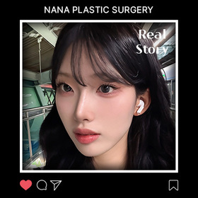김사라님의 기본코 절골 매부리 짧은코 복코 무보형물 후기