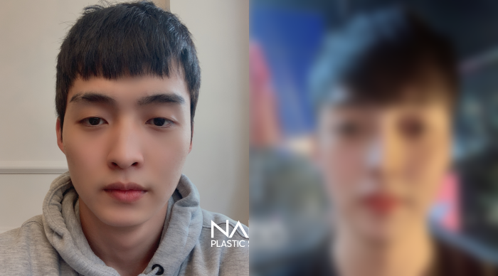 전후사진 전후사진