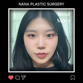 오다인님의 포니테일리프팅 후기