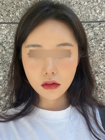 고우리님의 포니테일리프팅 후기
