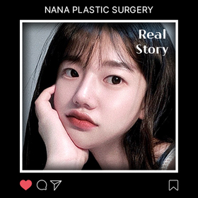 조수인님의 안면윤곽 후기