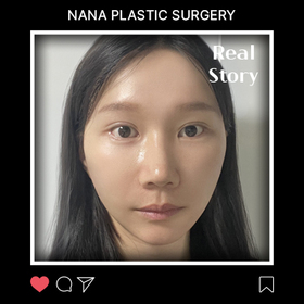 이미정님의 리프팅 후기