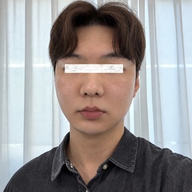 김재광님의 포니테일리프팅 후기