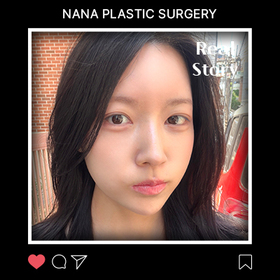 정설연님의 얼굴 후기
