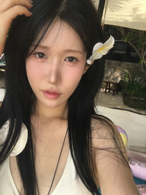 키키또끼님의 연조직윤곽술 후기