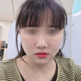 양차님의 연조직윤곽술, 미니거상 후기