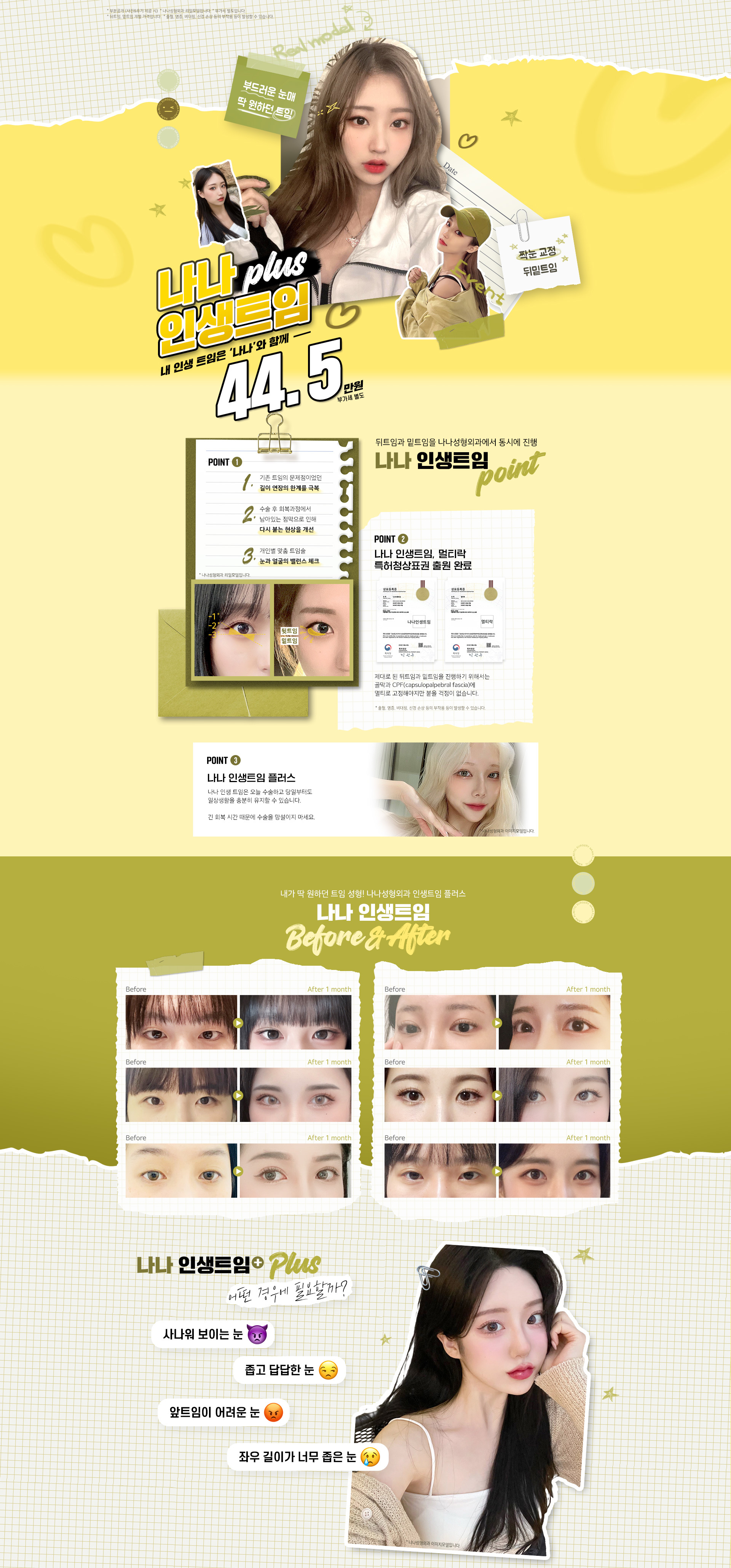 인생트임(뒤밑트임)
