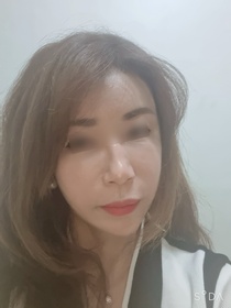 경화로운님의 안면거상 후기