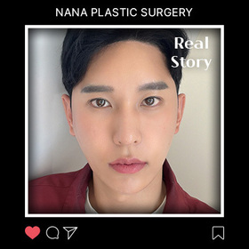 정민기님의 안면윤곽 후기