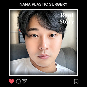 노기종님의 안면거상 후기
