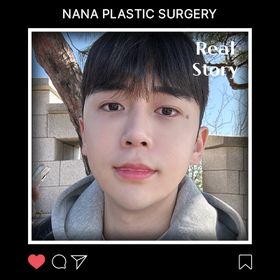 꽉꽊이님의 안면윤곽 3종 후기
