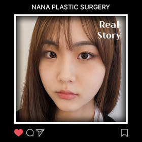 박주희님의 눈 후기