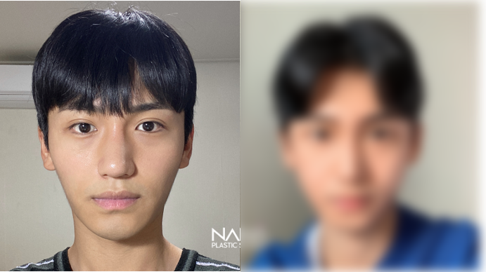 전후사진 전후사진