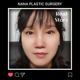 이계자님의 민트실리프팅 후기