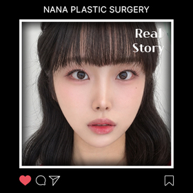 이나현님의 포니테일리프팅 후기