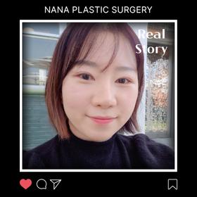 노연진님의 미니리프팅 후기