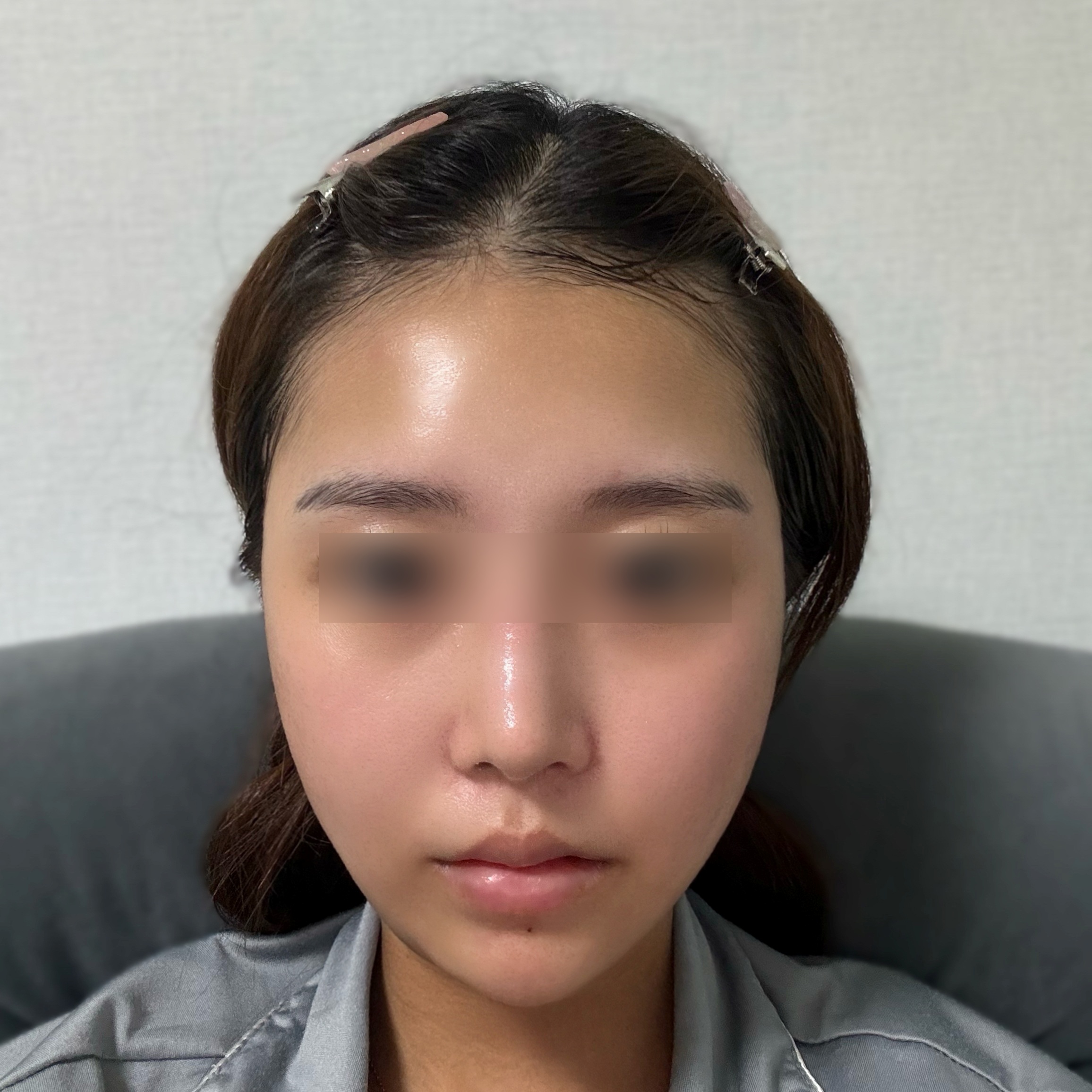 포니테일리프팅 후기