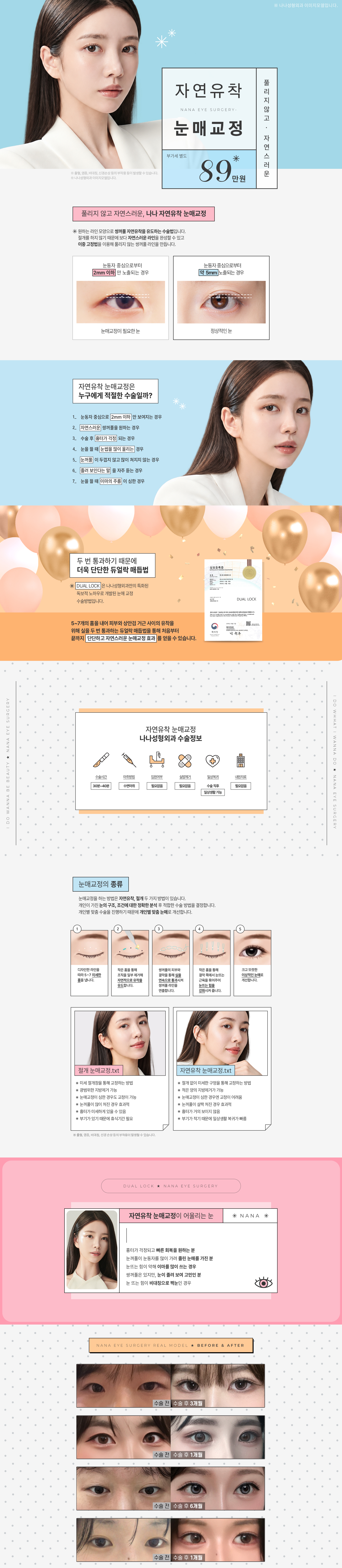 자연유착 눈매교정