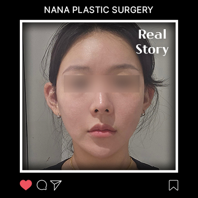 포니테일리프팅 후기
