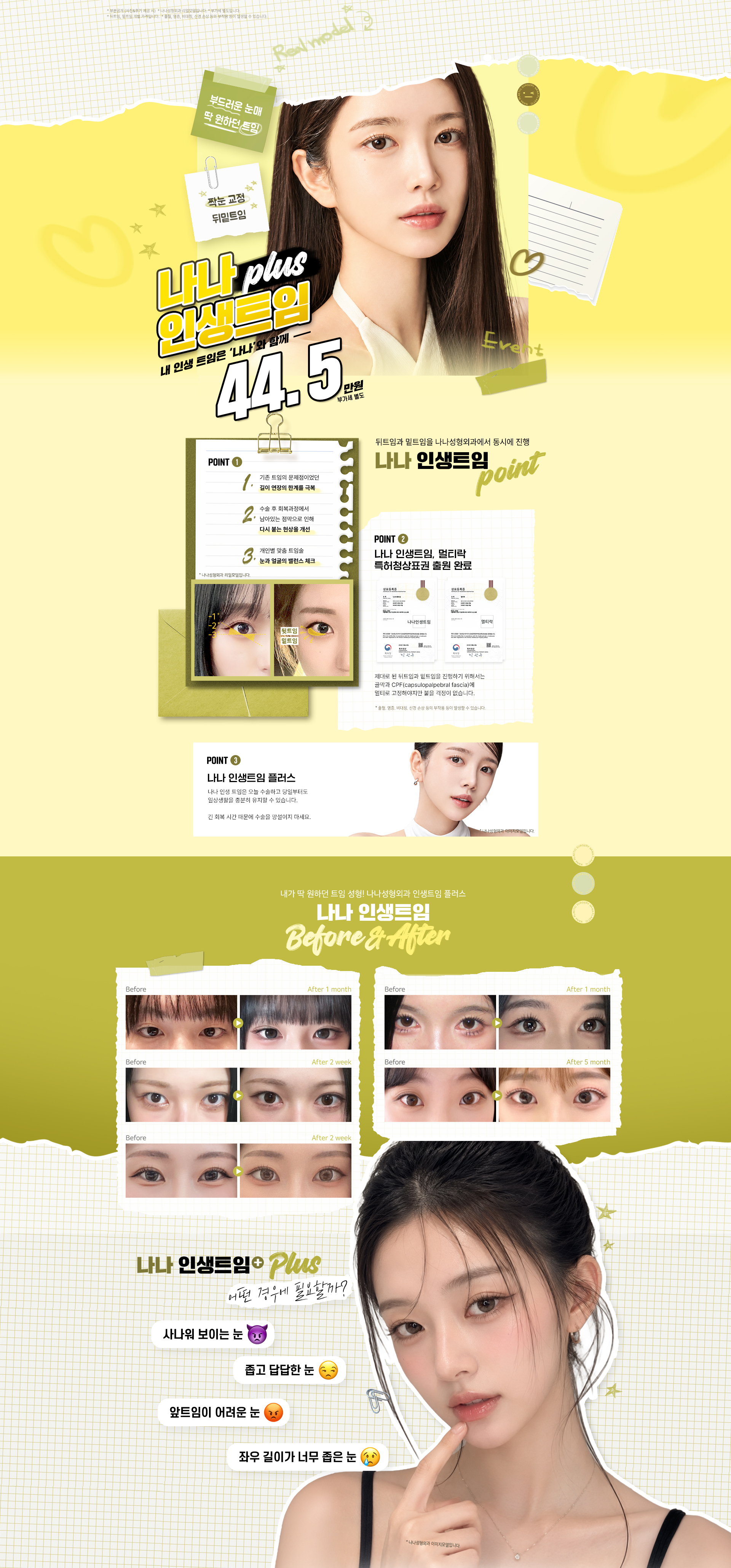 인생트임(뒤밑트임)
