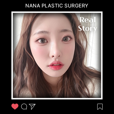 오혜진님의 안면윤곽 후기