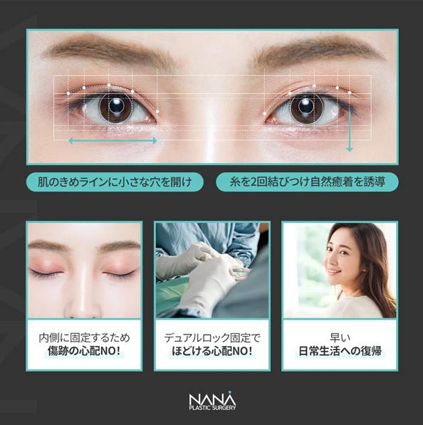 二重整形　二重埋没　自然癒着法　二重ライン　目整形