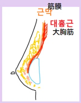 韓国整形 豊胸 谷間 バストアップ 垂れ乳